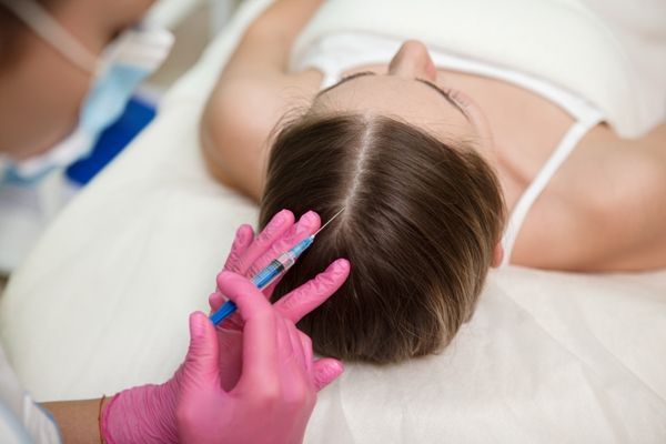 alopecia femenina - mujer en tumbada en la camilla de la consulta de un especialista recibiendo una inyección para mejorar la salud de su cabello