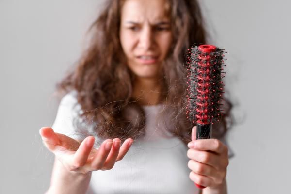 alopecia femenina - mujer joven preocupada por los abundantes mechones de pelo que se quedan en el cepillo tras es el cepillado