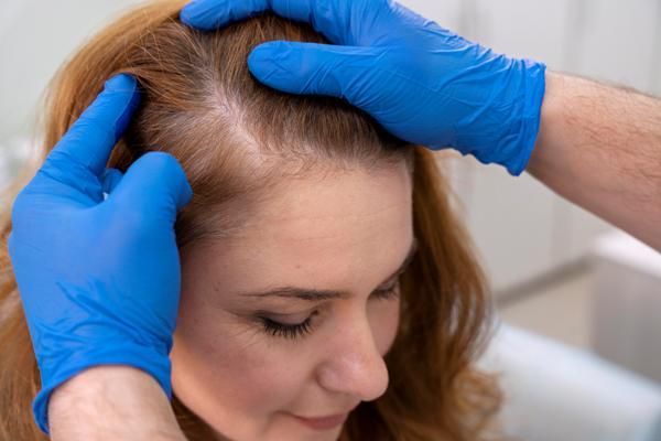 mujer en la consulta del tricólogo realizándose una evaluación del cabello ante la perdida de densidad en la zona de las sienes