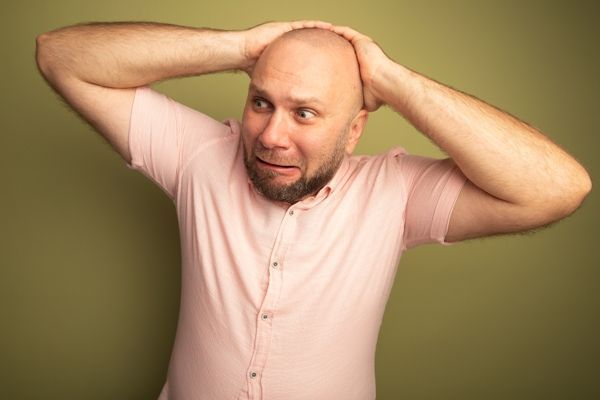 hombre con graves problemas de alopecia se echa las manos a la cabeza preocupado por su enfermedad