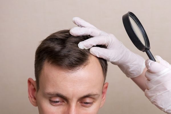 paciente en la consulta del tricólogo realizándose una revisión para comprobar si sufre algún tipo de alopecia y cual es el tratamiento que necesita