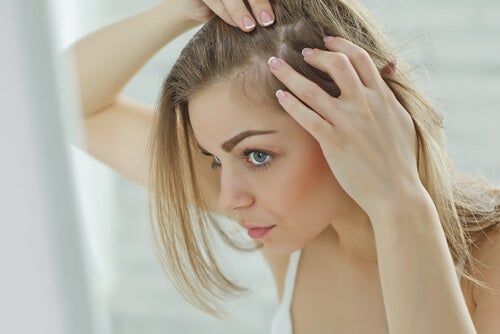 alopecia femenina - mujer joven delante del espejo revisando su cabello ante la perdida de densidad capilar en uno de los laterales de su cabeza