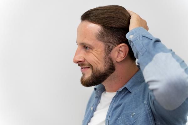 Injerto de cabello 10 años después - Hombre adulto pasando la mano por la melena, a gusto con los resultados de los implantes