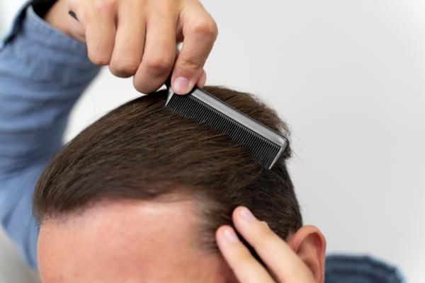 imagen de la parte superior de la cabeza de un hombre que esta peinando su cabello hacia atrás con un peine de plástico y dientes estrechos