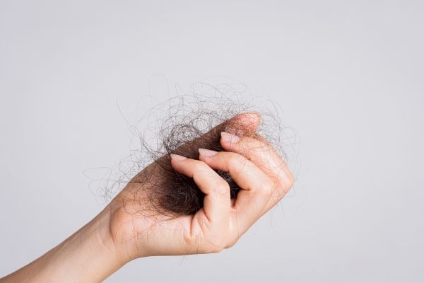 champús para estimular el crecimiento del pelo - mano de mujer sujetando un gran mechón de pelo caído
