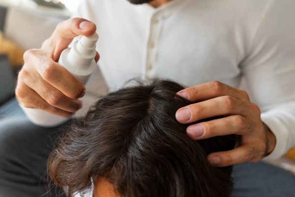 Padre aplicando una loción antifúngica en el cabello de su hijo, para curar la infección que presenta en el cuero cabelludo