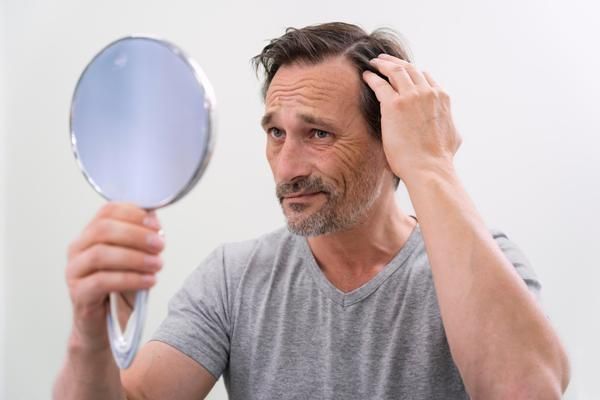 Injerto capilar infectado - Hombre observando en el espejo que comienza a presentar síntomas de una infección en el cuero cabelludo, luego de realizarse un implante de cabello