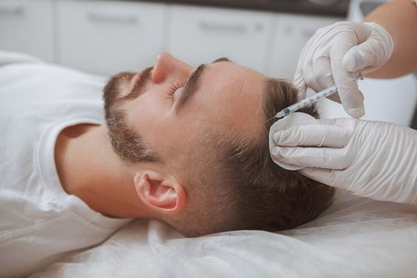 alopecia nerviosa - paciente en la camilla del especialista recibiendo un tratamiento capilar en forma de inyección para tratar sus problemas de alopecia