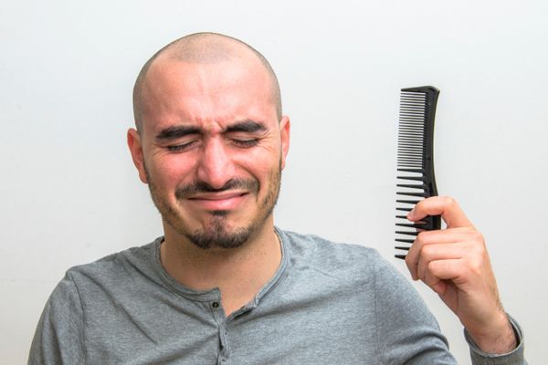 entradas en el cabello - hombre con problemas graves de alopecia a punto de llorar mientras sostiene un peine en su mano izquierda