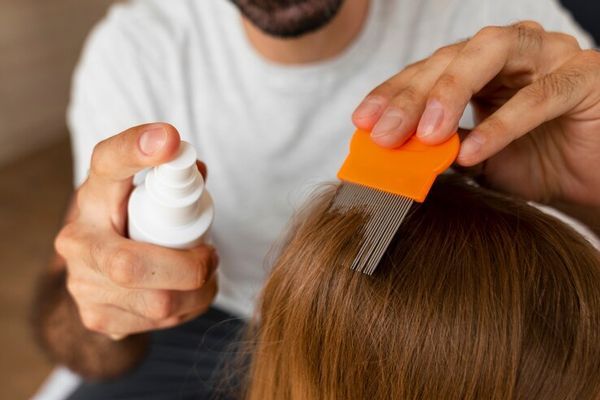 pica la cabeza - hombre aplicando un tratamiento anti piojos a un niño
