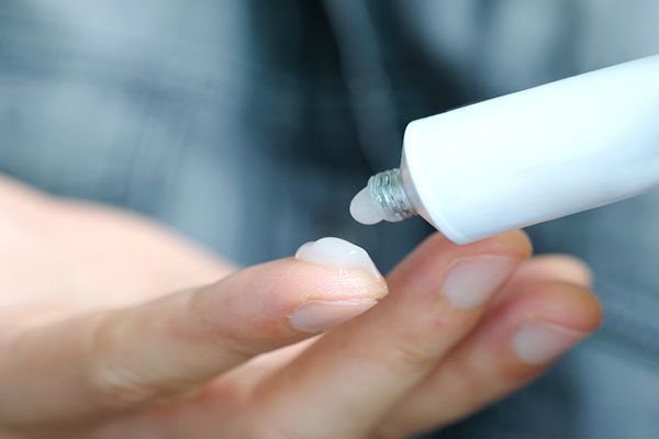 pica la cabeza - hombre aplicando una crema en la yema del dedo para tratar la irritación e inflamación del cuero cabelludo