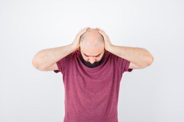 salud mental - hombre con graves problemas de alopecia agarrándose la cabeza