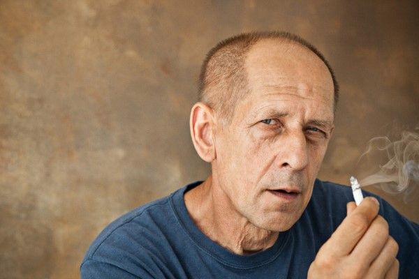 Fumar aumenta la caída del pelo - hombre mayor con problemas de alopecia y un cigarro encendido en la mano