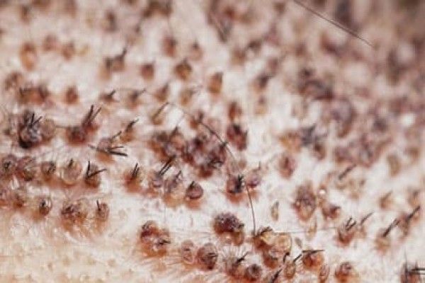 imagen de las costras de las unidades foliculares días después del injerto capilar