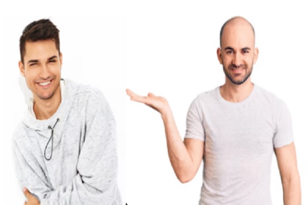 Donar pelo- hombre calvo señala a joven con cabellera abundante 