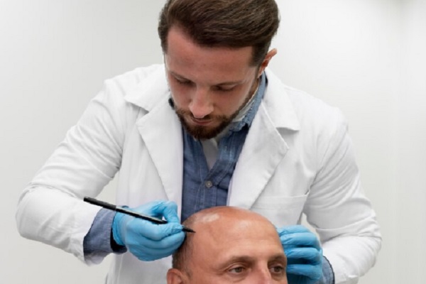donar pelo- tricologo prepara a paciente para injerto capilar 