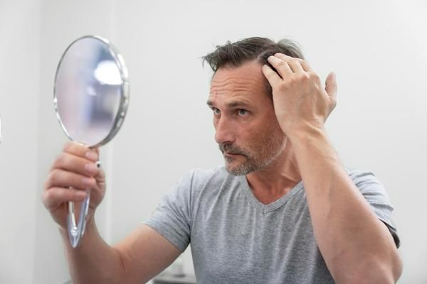 Hombre observando que comienza a perder cabello por no usar un champú adecuado