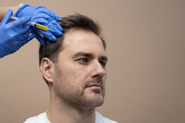 Zona donante - Doctor extrayendo los folículos pilosos que usará para el trasplante de cabello en el paciente