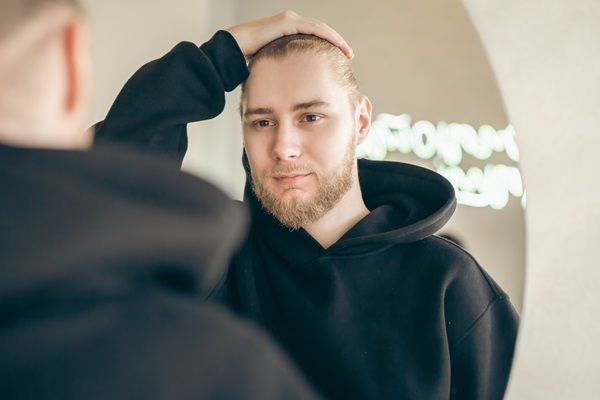 Hombre mirando al espejo luego de realizarse el tratamiento de micropigmentación para ocultar la alopecia