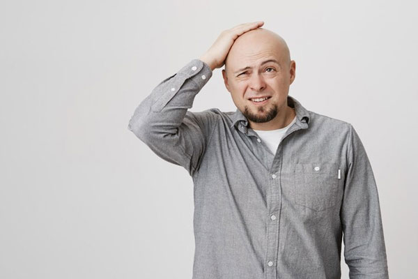 Testosterona y caída del cabello - Hombre toca su cabeza visiblemente afectado por los estragos de la alopecia 