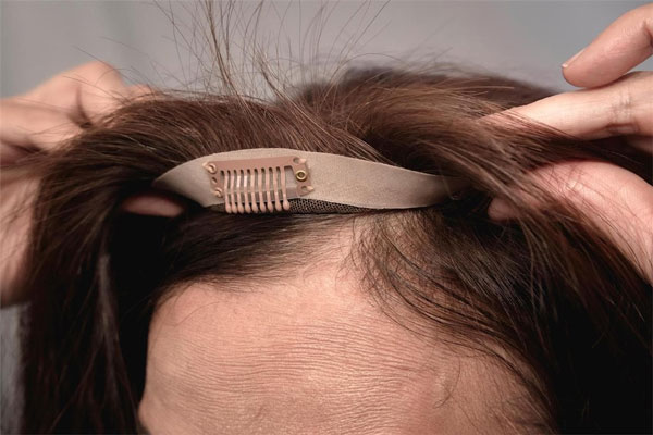 Mujer con problemas de alopecia recurre a una solución provisional para minimizar la visibilidad de la pérdida de cabello