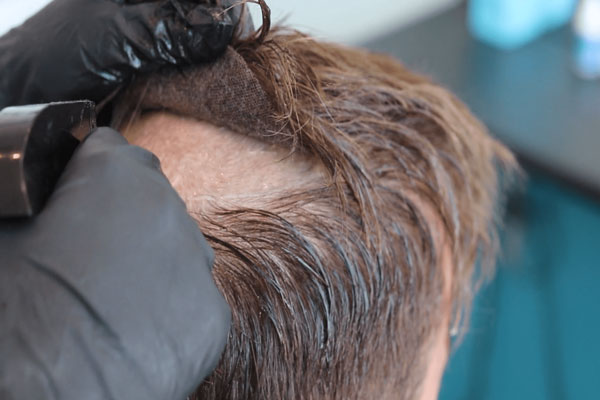Prótesis capilar - Especialista en cuidado capilar renueva la pega de una pieza de cabello sintético para mejorar el aspecto de la coronilla