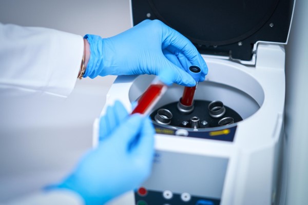 PRP capilar - imagen de un técnico de laboratorio colocando dos tubos de muestras con sangre en la centrifugadora