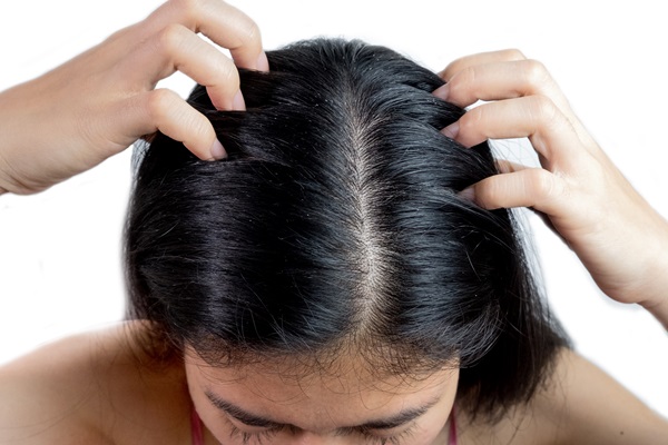 Mujer con cabello reseco debido a una deficiencia de queratina, la cual afecta a la salud del pelo y los dientes