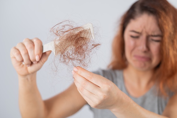 Caries y calvicie - Mujer sufriendo de alopecia areata, debido a la infección bucal que presenta por las caries