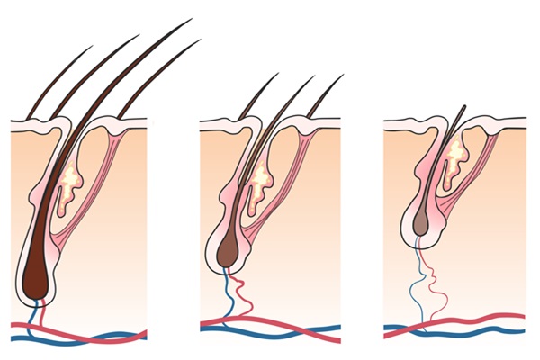 Imagen representativa del cabello en sus diferentes ciclos, desde la etapa inicial hasta su caída