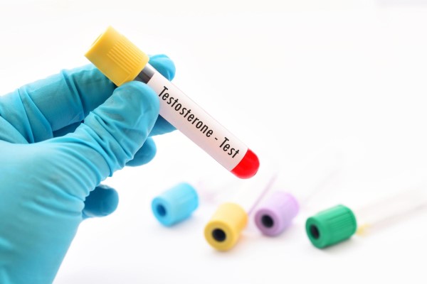 mano de técnico de laboratorio con un tubo de ensayo para la prueba de la testosterona