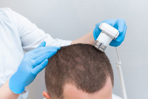 Tricóloga realiza una evaluación exhaustiva del cuero cabelludo de un joven con caída del cabello