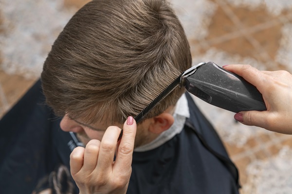 Pelo tras injerto capilar - Barbero utilizando una máquina de afeitar para cortar el cabello de un hombre, tras pasar 5 meses desde el implante capilar