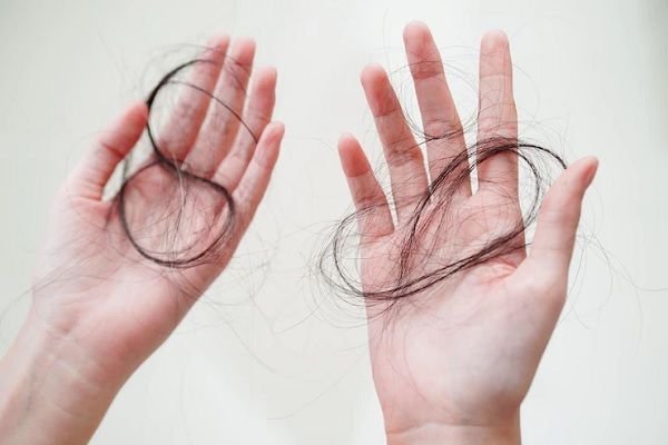 alopecia androgénica en mujeres - manos de mujer con mechones de pelo en ellas