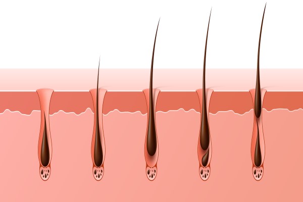 shock loss tras el injerto capilar - fases del crecimiento del cabello