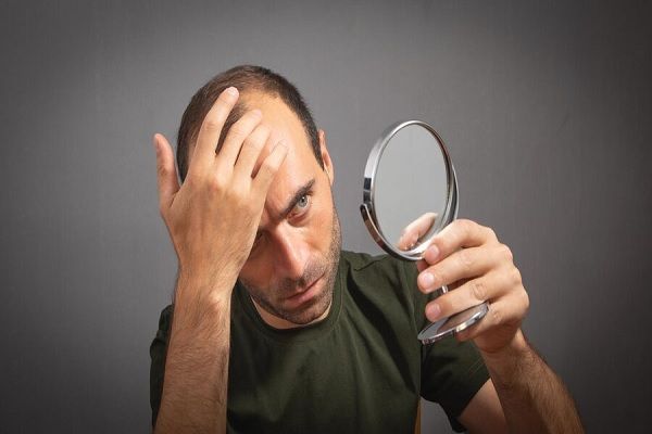 shock loss tras el injerto capilar - hombre revisando en un espejo el avance de la alopecia