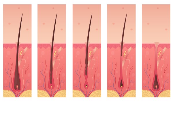  dibujo de las distintas fases del crecimiento del cabello