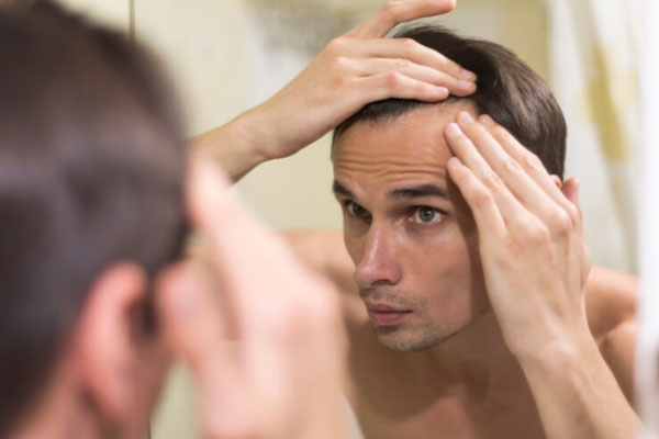 Grados de alopecia - Joven frente al espejo observa con preocupación el avance de sus entradas en el cabello 