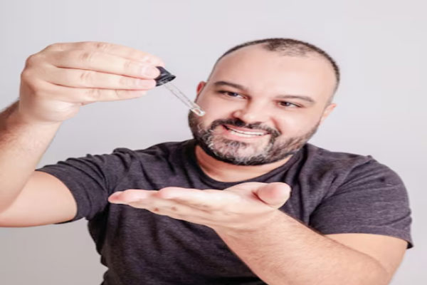 Joven calvo utiliza minoxidil en versión tópica para desacelerar la caída del cabello 