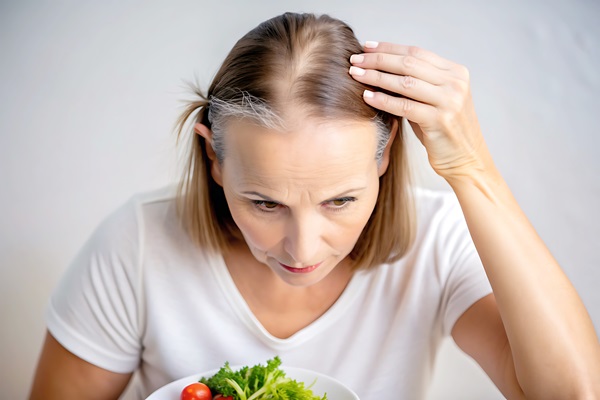 Mujer con pérdida de cabello y canas tocándose con la mano la cabeza