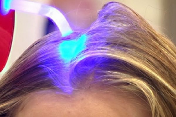Láser capilar - Mujer de cabello teñido recibe un tratamiento capilar para estimular el crecimiento de nuevo pelo