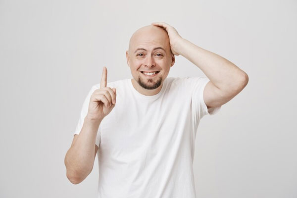 Sistema de integración capilar - Hombre calvo busca soluciones capilares para disimular la alopecia