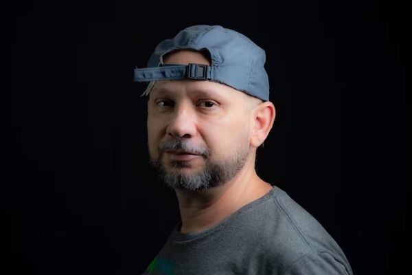 Caer el cabello - Hombre con alopecia usa una gorro para ocultar la pérdida de cabello