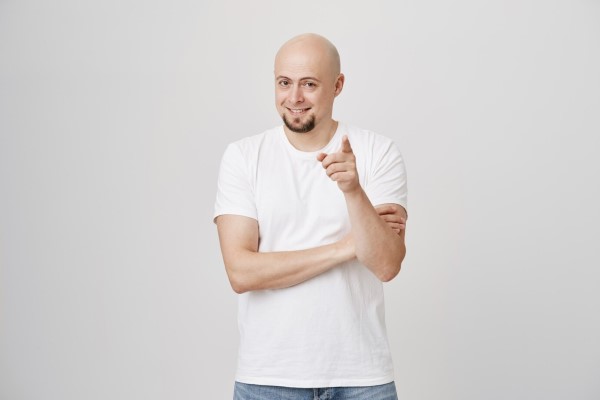 pelo injertado - hombre con problemas muy graves de alopecia que hace inviable un injerto capilar