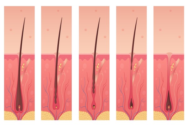pelo injertado - dibujo de las distintas etapas del crecimiento del cabello