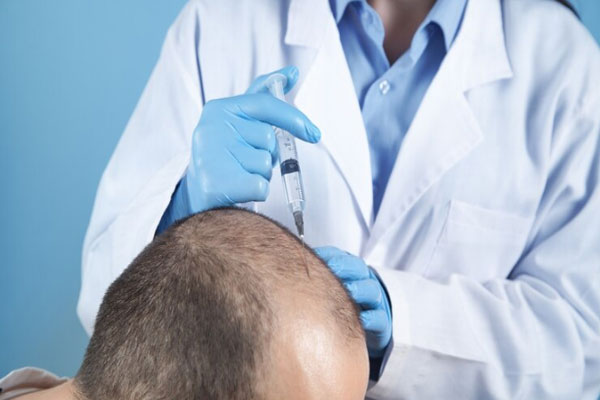 Duele el injerto capilar - Tricóloga administra anestesia local para llevar a cabo un trasplante de cabello sin dolor 