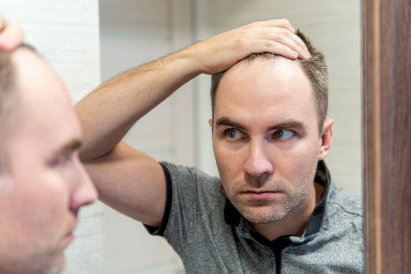 Hombre con entradas y pérdida de cabello se mira con preocupación frente al espejo 