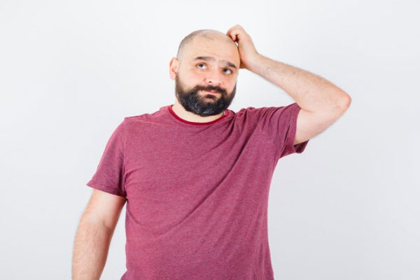 Caer el cabello - Hombre calvo y preocupado rasca su cabeza en busca de tratamientos para combatir la alopecia