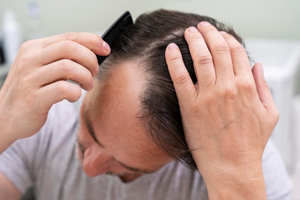 Hombre con alopecia peinando su cabello de manera suave para no dañar los folículos pilosos