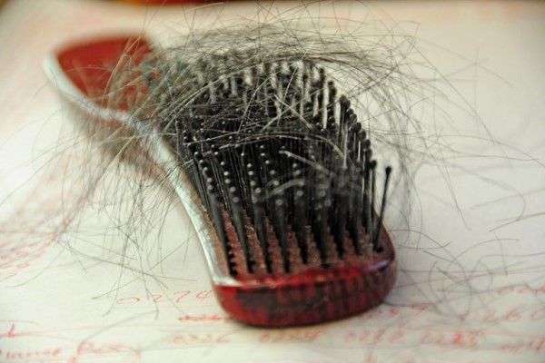 famosas que sufren alopecia